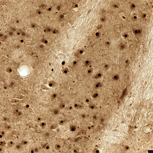 Sagittal striatal sections in HdhQ150 mice aged 12 months using DSHB antibody immunostained with DSHB antibody MW8 anti-Huntingtin. PMID: 31282030, Fig. 2F.